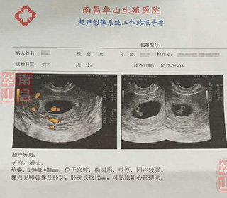 检查报告单